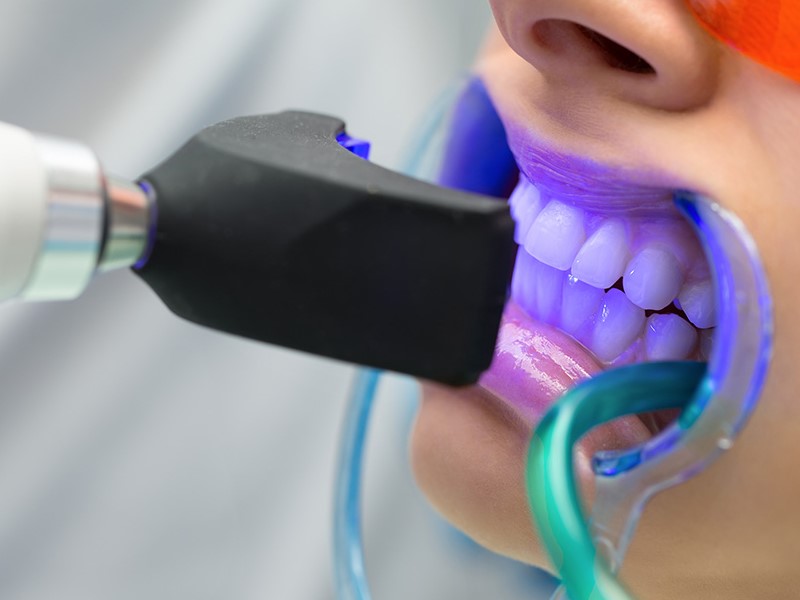 postopek beljenja zob